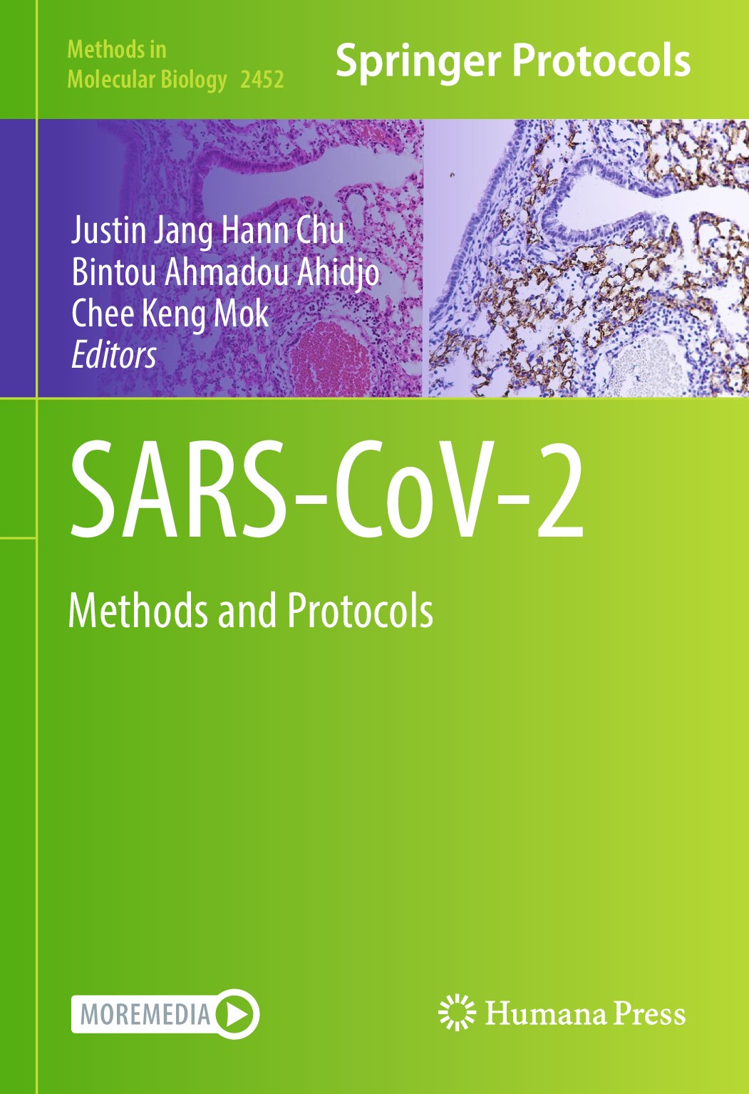 SARS-CoV-2_Methods_and_Protocols_(Justin_Jang_Hann_Chu,_Bintou_Ahmadou_Ahidjo_etc.)_(z-library.sk,_1lib.sk,_z-lib.sk)