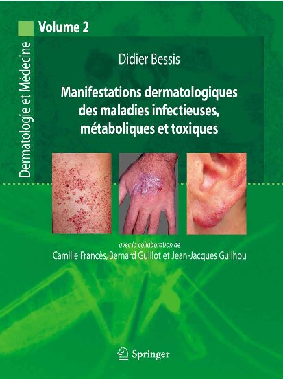 Manifestations dermatologiques des maladies infectieuses, -- Didier Bessis; Clas Neumann -- 1 edition, January 2008 -- Springer-Verlag France -- isbn13 9782287338854 -- 89c83d12302ec4196984e9ebe3dea2a9 -- Anna’s Archive
